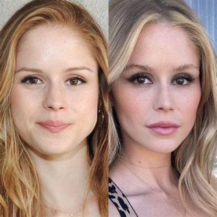 Erin Moriarty | Plastic Surgery Before And After