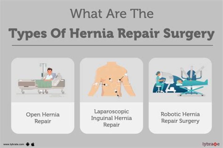 Jeffrey Dahmer Surgeries List, Double Hernia Childhood Surgery Explained ·