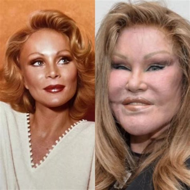 Jocelyn Wildenstein Before And After Plastic Surgery Young Photos- Where Is She Now? ·