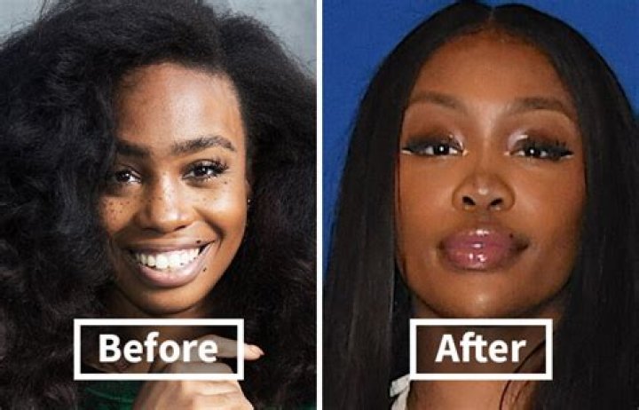 SZA Before Surgery: How the Singer Transformed Her Looks and Voice
