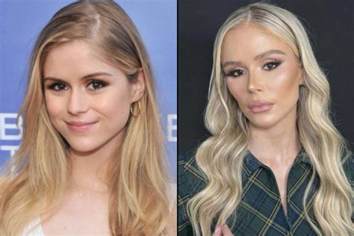 Unveiling The Secrets Of Susan Page's Plastic Surgery Journey